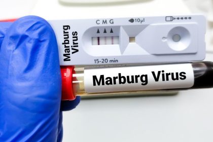 Africa CDC Launches Immediate Response To Tanzania Amid Marburg Virus Outbreak