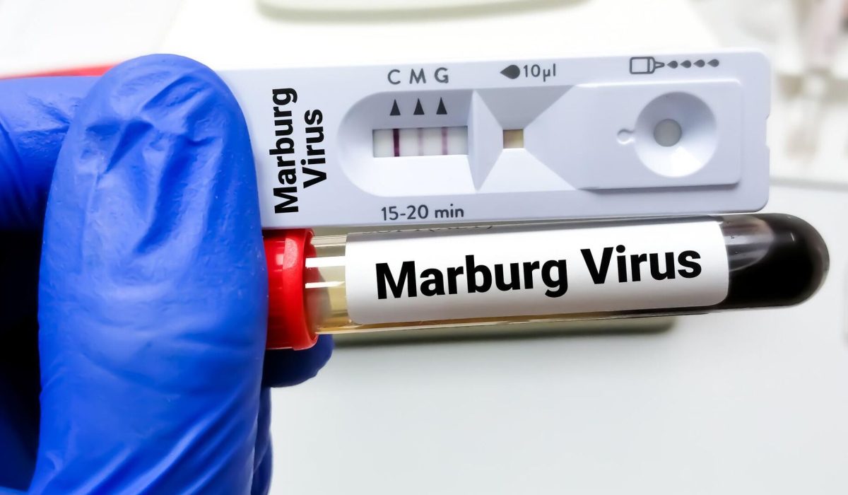 Africa CDC Launches Immediate Response To Tanzania Amid Marburg Virus Outbreak