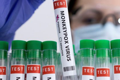 China Reports 5 Cases Of New Mpox Strain