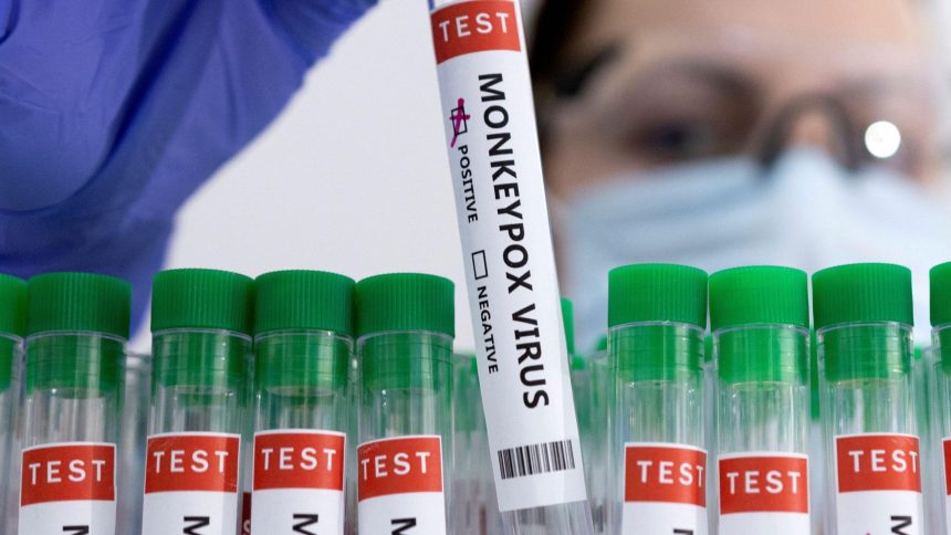 China Reports 5 Cases Of New Mpox Strain